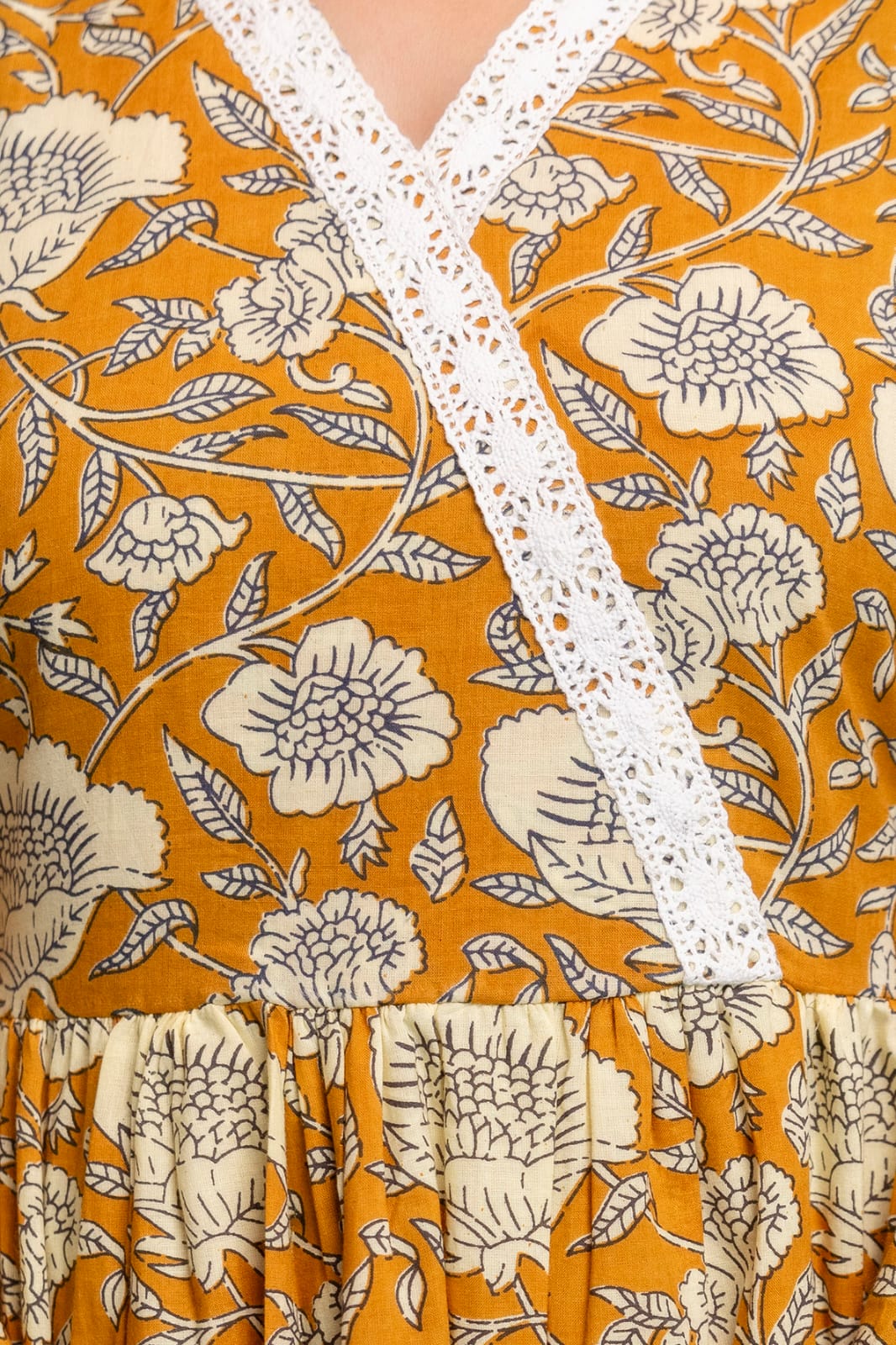 Mustard Floral Cotton Short Kurti – V Neck Lace Detail