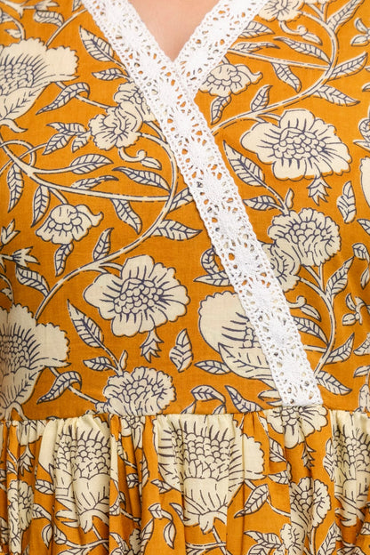 Mustard Floral Cotton Short Kurti – V Neck Lace Detail